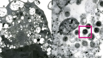 Hay una nueva ómicron ya está en más de 40 países y sería 1,5 veces más infecciosa