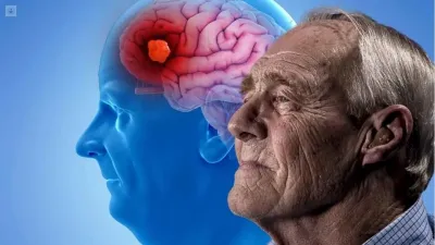 Un método bahiense diagnostica Alzheimer años antes de que aparezcan los síntomas