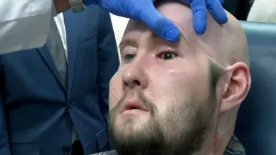 Un hombre recibe con éxito el primer trasplante de ojo completo en el mundo