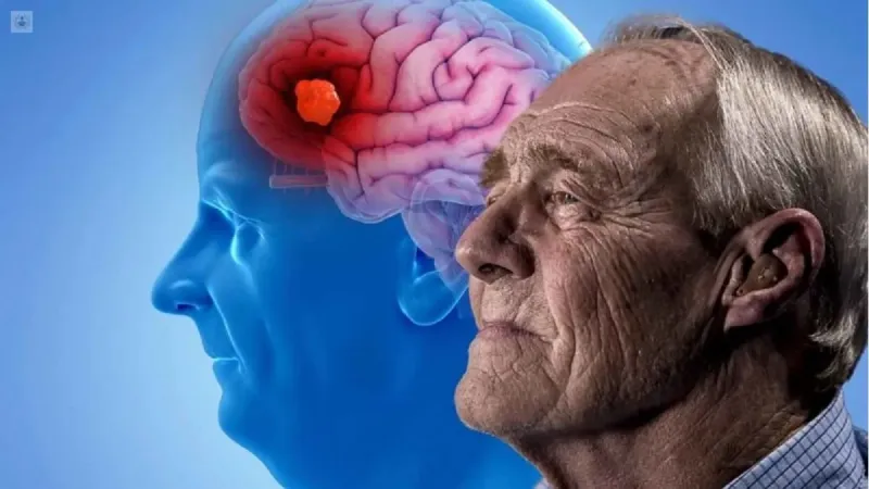 Un método bahiense diagnostica Alzheimer años antes de que aparezcan los síntomas