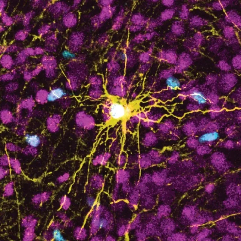 Imagen de microscopio que muestra un astrocito humano, el centro en amarillo, y células gliales humanas (dispersas en azul) dentro del cerebro de una rata.