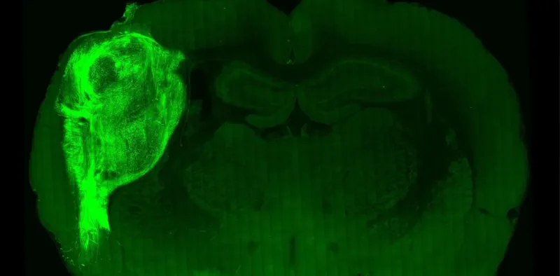 La Universidad de Standford publicó la foto que muestra el cerebro de una rata con proteínas fluorescentes para resaltar las células cerebrales humanas trasplantadas