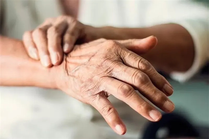 Parkinson, la segunda enfermedad neurodegenerativa más frecuente después del Alzheimer