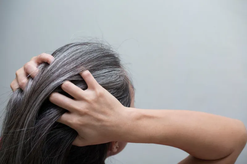 El cabello se vuelve gris cuando las células madre productoras de melanina dejan de hacer su trabajo correctamente