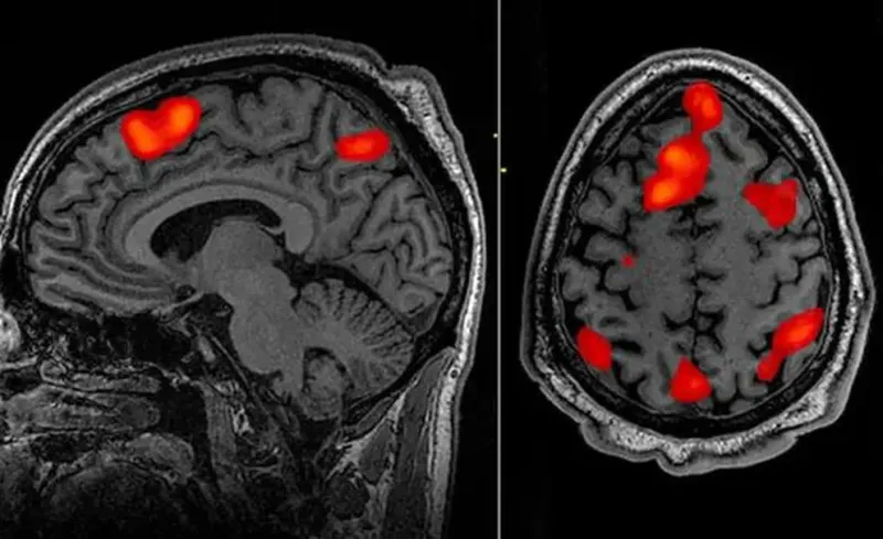  El decodificador puede reconstruir el habla utilizando datos de escaneo fMRI.