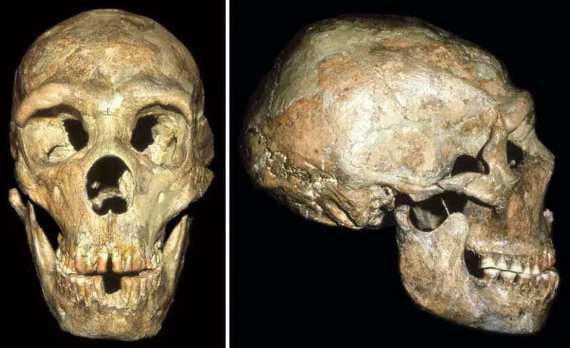 El cráneo de un Neandertal, conocido como Shanidar 1. Era sordo y contó con la ayuda de otros para sobrevivir más de 40 años. Sus restos se encontraron en Irak