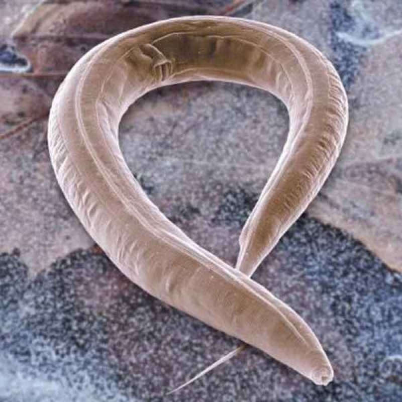  Imagen microscópica de un gusano nematodo C.elegans /EFE/CSIC