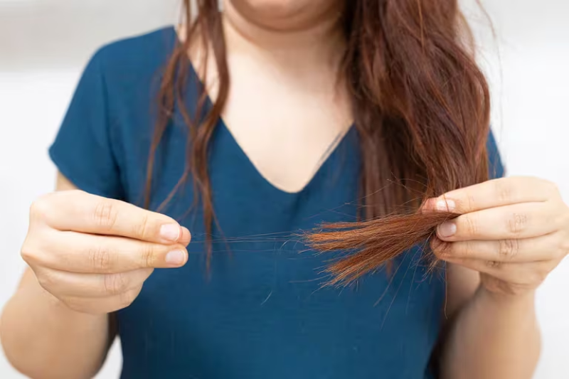  Hay tres tipos de caída del pelo que pueden asociarse a niveles elevados de estrés: el efluvio telógeno, la tricotilomanía y la alopecia areata (Gentileza: Rocco)